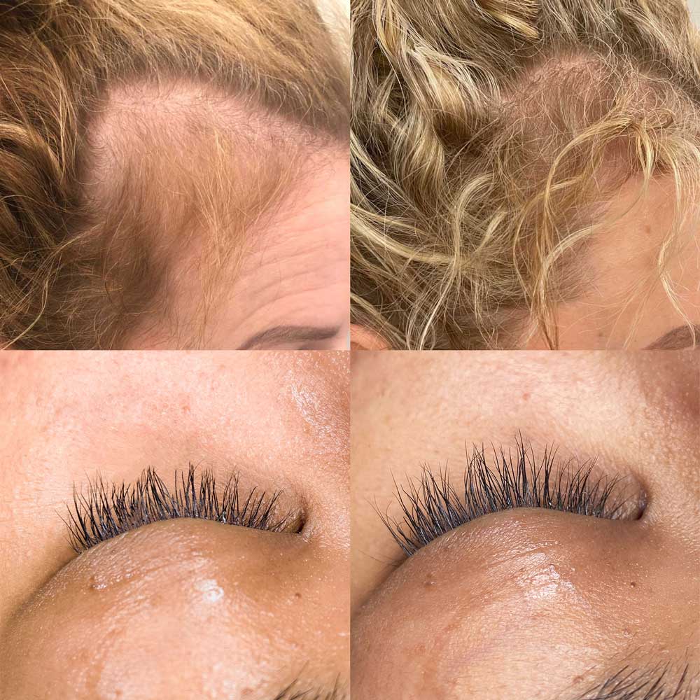 Before and after results using Growin' and Showin' | Biotin Spray on hairline and eyelashes showcasing hair growth and thickness improvement.